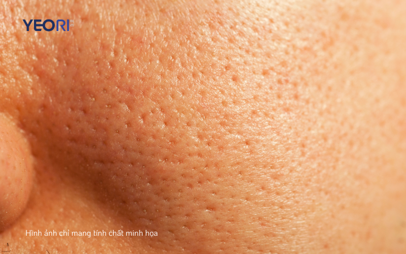 Da-gian-no-lo-chan-long