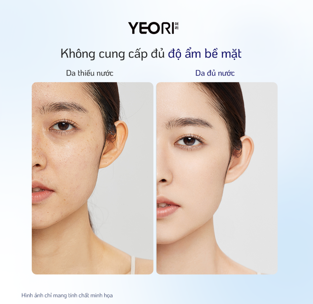 Khong-cap-du-do-am-cho-da