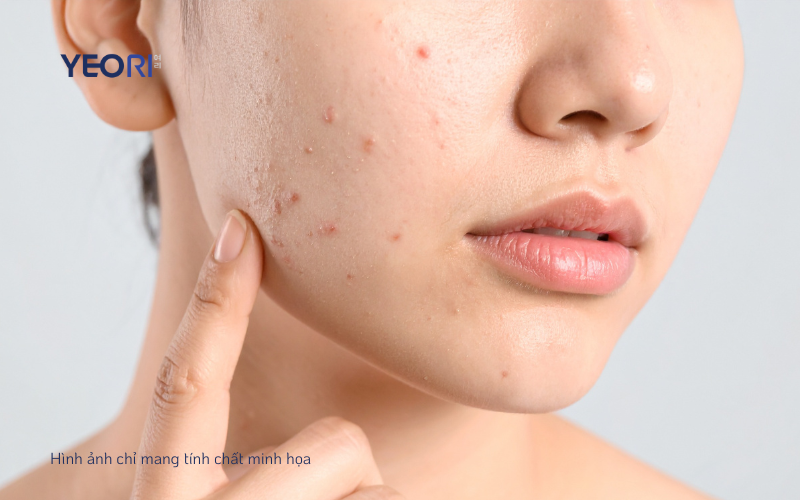 3 DẤU HIỆU CHO THẤY HÀNG RÀO BẢO VỆ ĐANG BỊ SUY YẾU